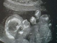 Iris's Baby photo